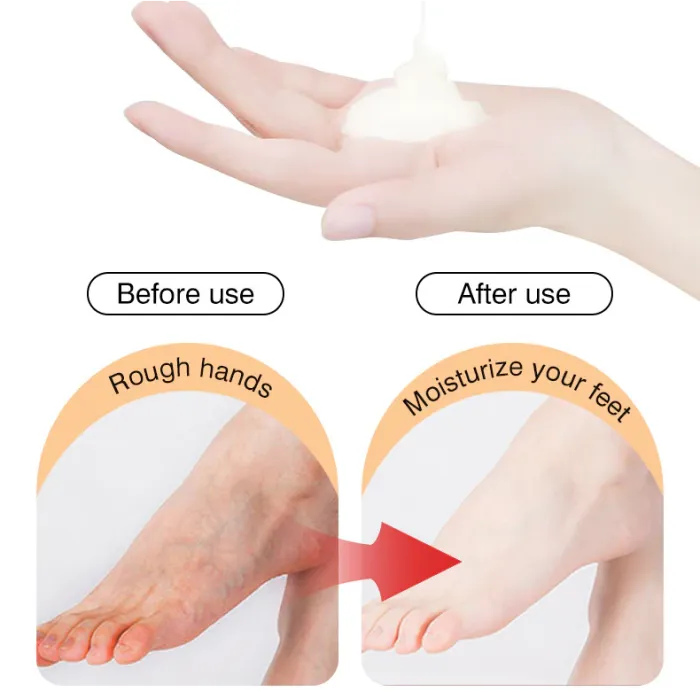 10 Pairs Ginger Foot Mask